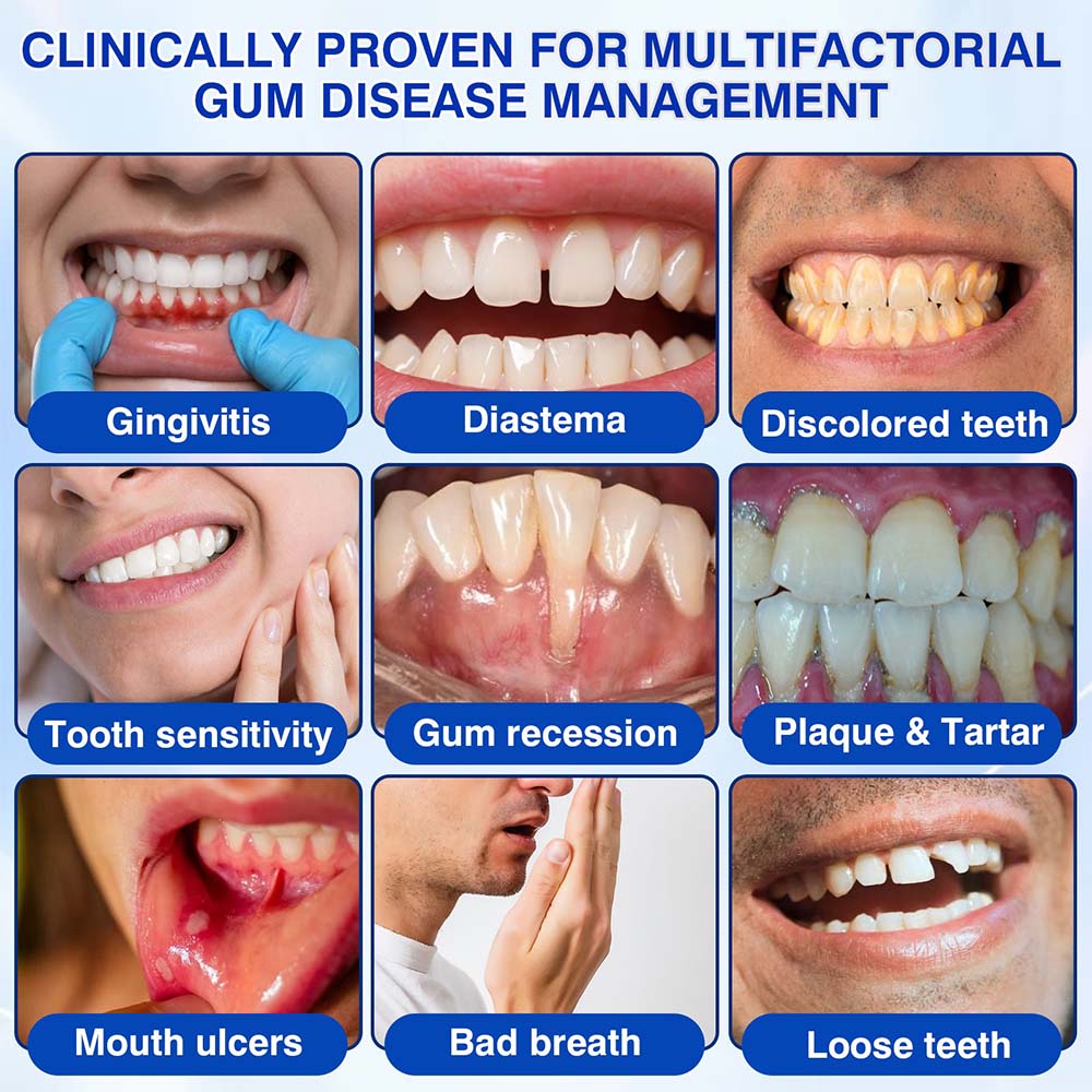 Healrize® GumRevive Periodontal Repair Gel (for bleeding gums, receding gums, and loose teeth)