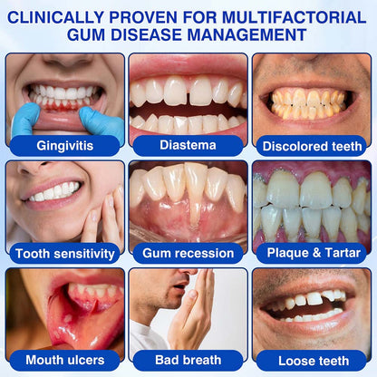 Healrize® GumRevive Periodontal Repair Gel (for bleeding gums, receding gums, and loose teeth)