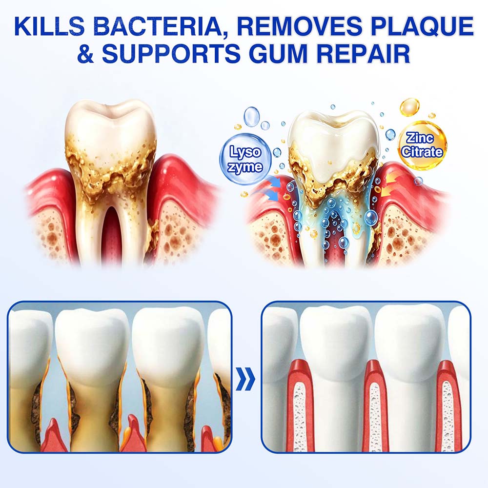 🦷🦢Healrize® GumRevive gel for the regeneration of the tooth-supporting apparatus (for bleeding gums, receding gums, and loose teeth)🐰