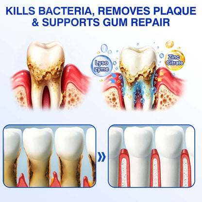 🦷🦢Healrize® GumRevive gel for the regeneration of the tooth-supporting apparatus (for bleeding gums, receding gums, and loose teeth)🐰